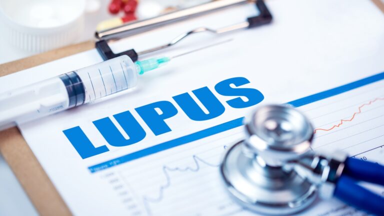 Ep. 18: Do You Want To Reverse Your Lupus?