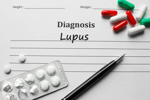 Ep. 60: Lupus and the Medical System